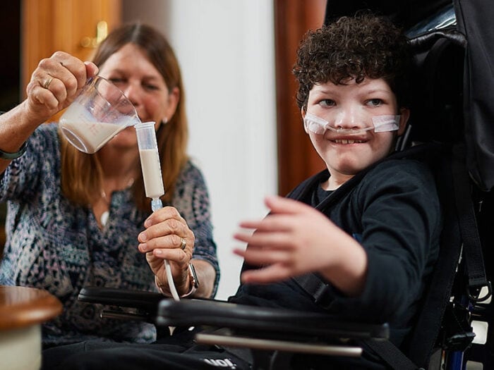 A young boy being PEG fed