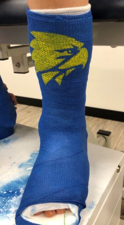 Jack's blue serial cast on his right leg with the yellow West Coast Eagles emblem painted on it. 